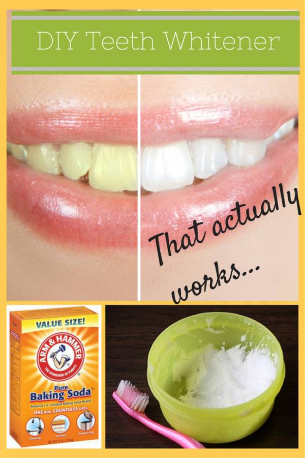 How to Whiten Your Teeth at Home