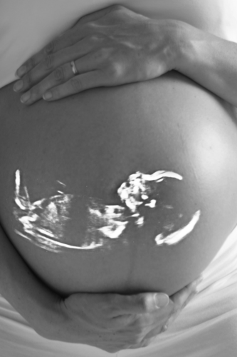 image of an ultrasound on a pregnant belly